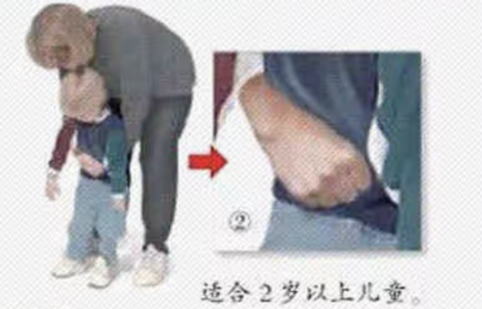 1岁娃吞咽3根6cm钢钉：孩子意外吞异物，家长应该怎么办？